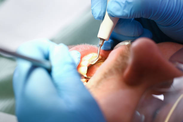 Best Mobile Emergency Dentist in New Hope, OR
